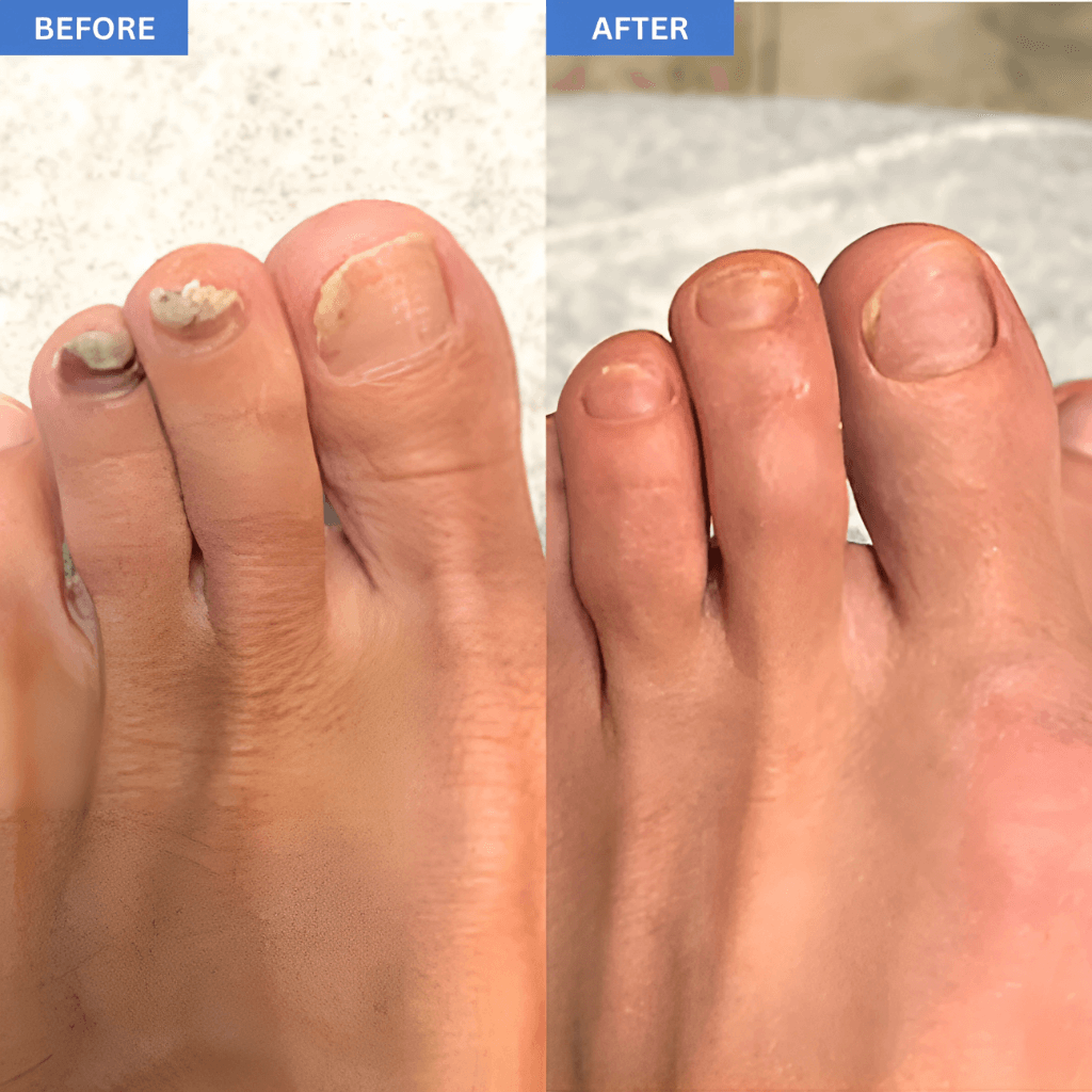 NailCure Pro™