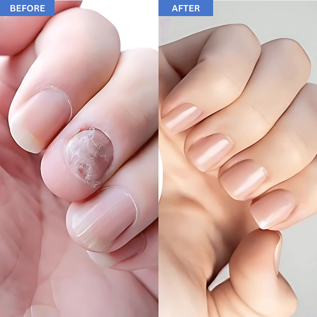 NailCure Pro™