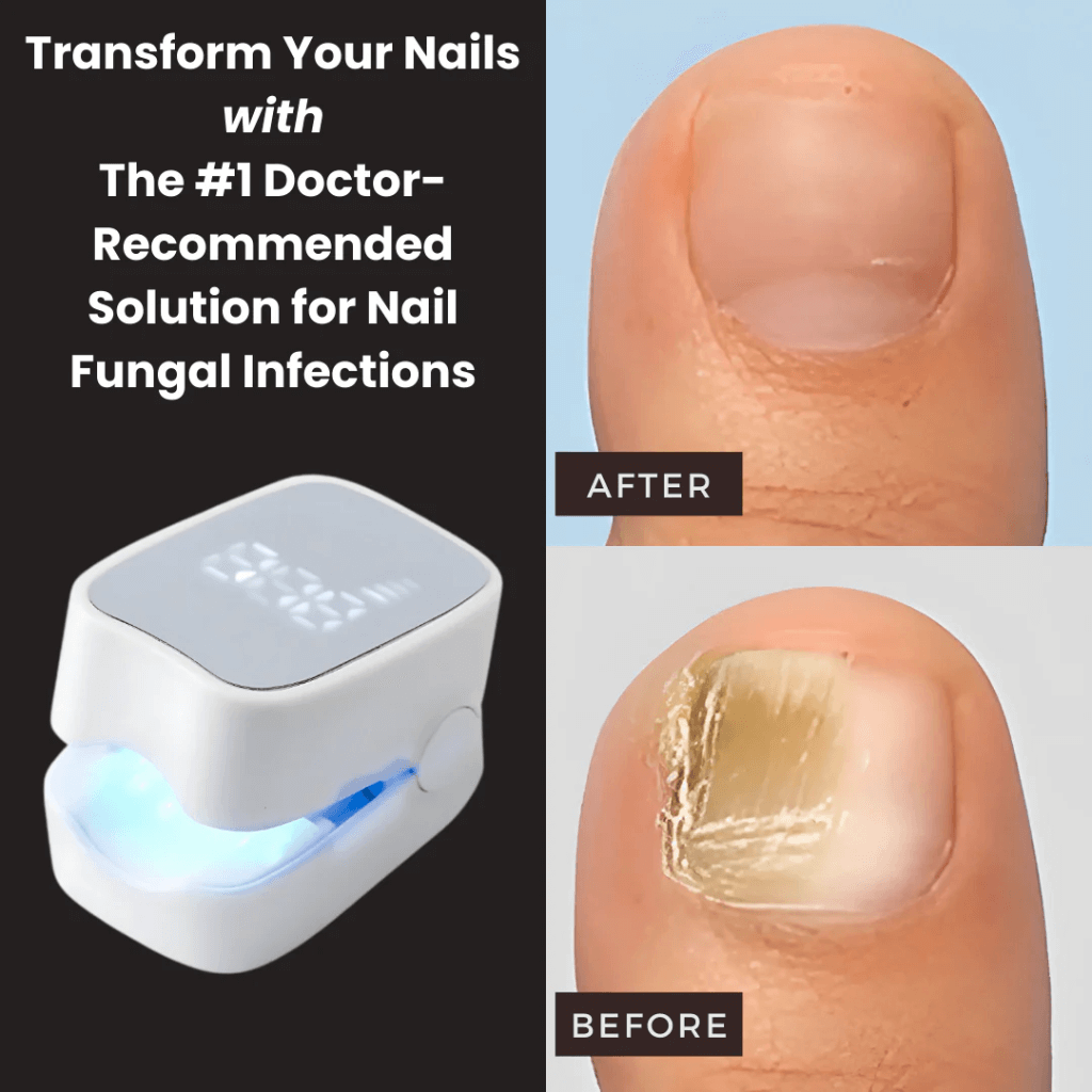 NailCure Pro™